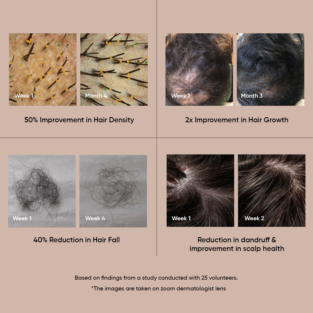 Hairfinity - Advance Hair Regrowth Serum image 4