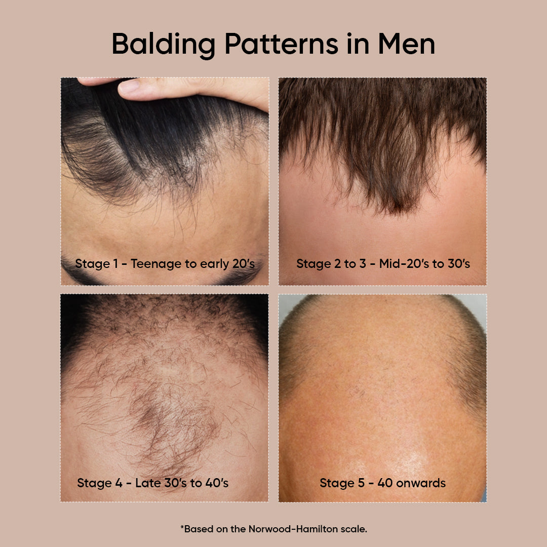 Hairfinity - Advance Hair Regrowth Serum image 5