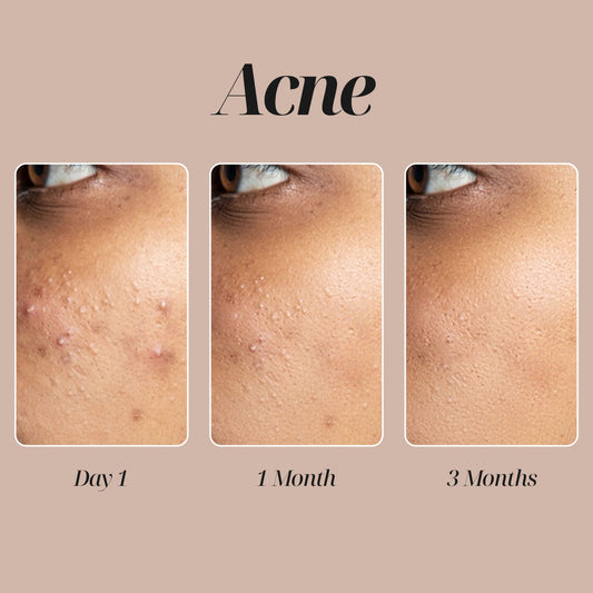 Chemical Free Skincare Skin Care Products for Women Buy Face Creams