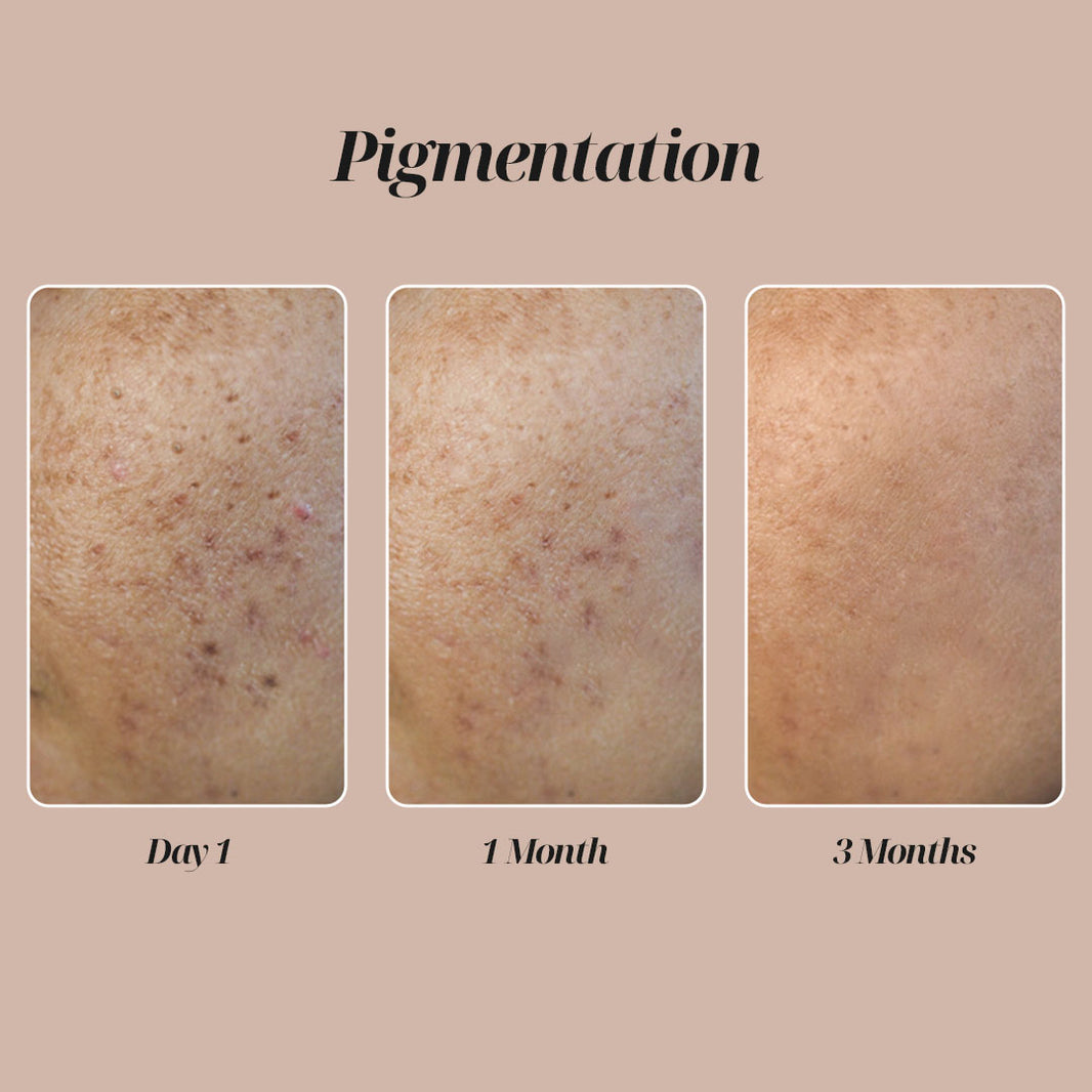 Chemical Free Skincare Skin Care Products for Women Buy Face Creams